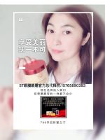 ST眼膜怎么代理?ST眼膜大区**有正品吗?