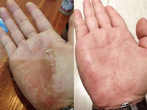 古村奇草是纯中药吗？有没有激素或副作用？